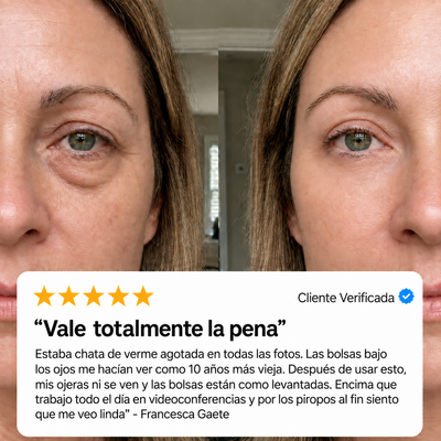 Tensor Instantáneo de Bolsas y Ojeras