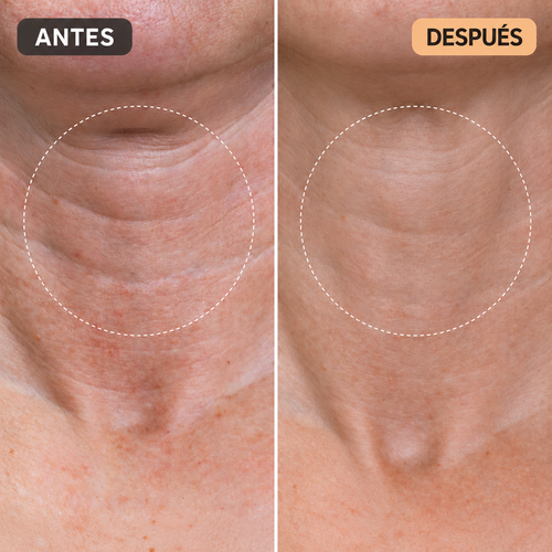 Stick Reafirmante Retinol+Colágeno